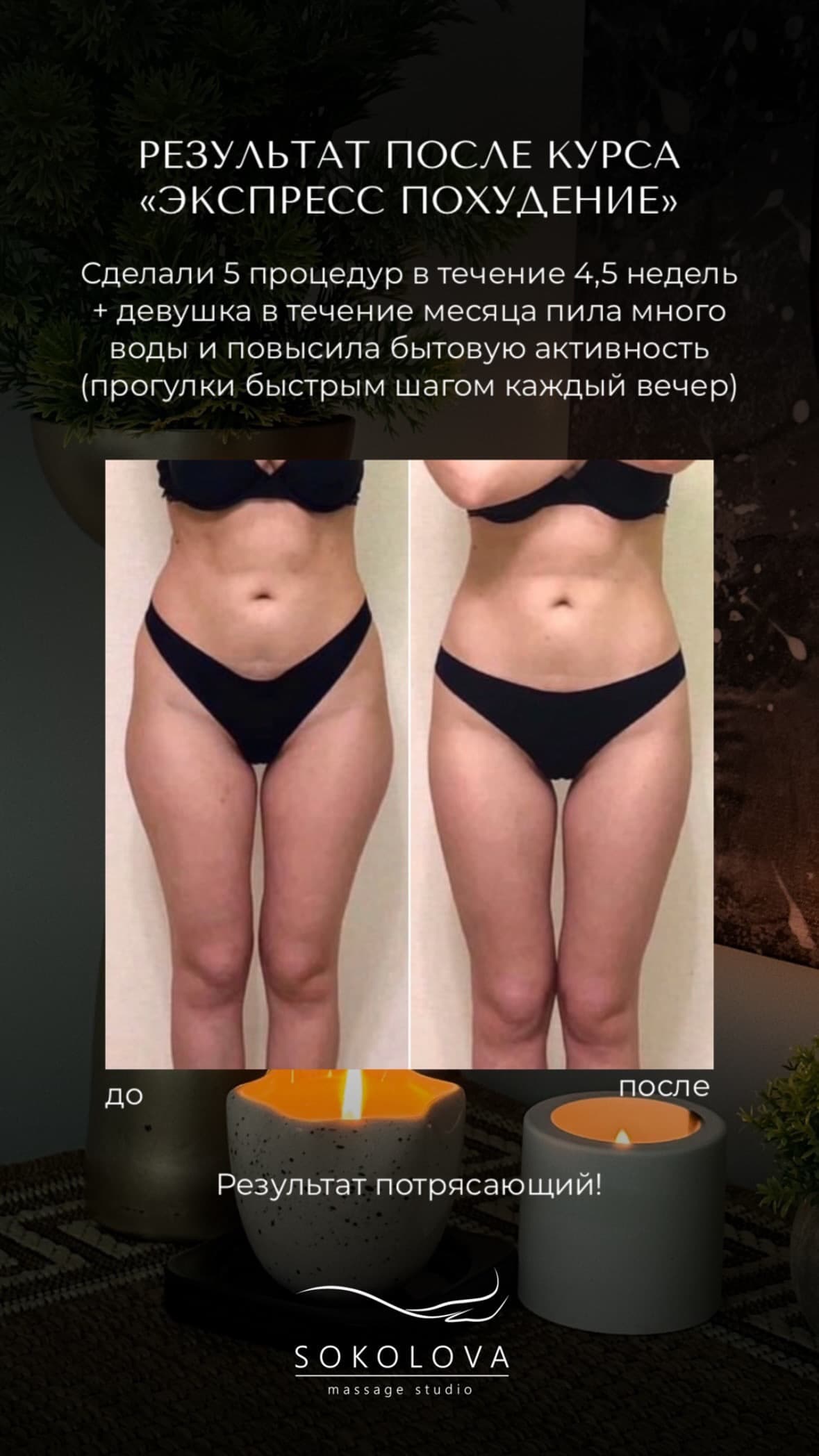 Результат лимфодренажа